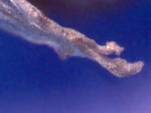 wing deformed by parasitic mite syndrome