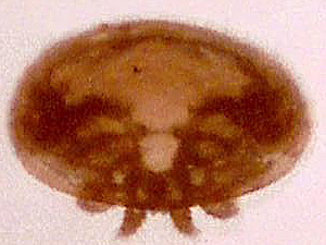 varroa mite at 60x bottom lit